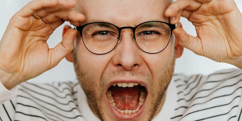 Bald Men with Beards Embracing the Bold Look